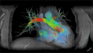 Artificial Intelligence Comes to Imaging